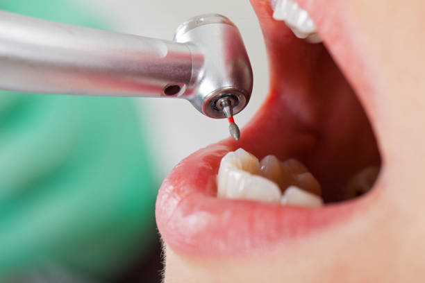 Best Pediatric Emergency Dentist in Elysburg, PA